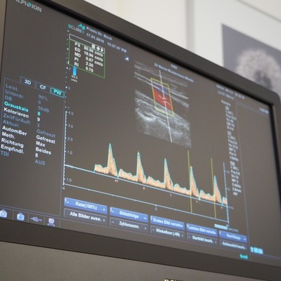 Neues Sonographiegerät Neues Sonographiegerät